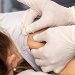 Acupuncture Tips For Stress And Anxiety Relief
